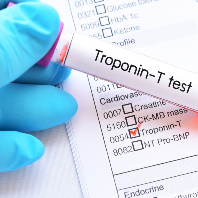 Importanța analizei troponinei T în diagnosticarea și monitorizarea bolilor cardiovasculare